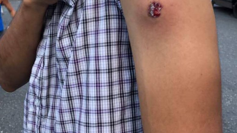 heridos en La Florida Caracas