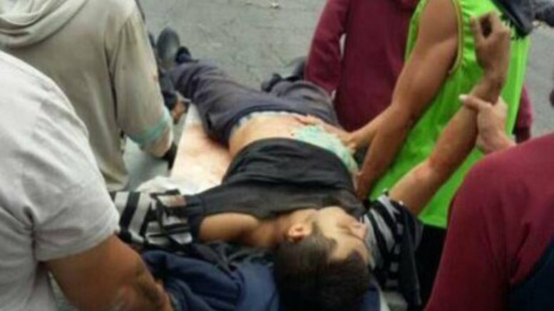 victimas de represión 30 julio venezuela