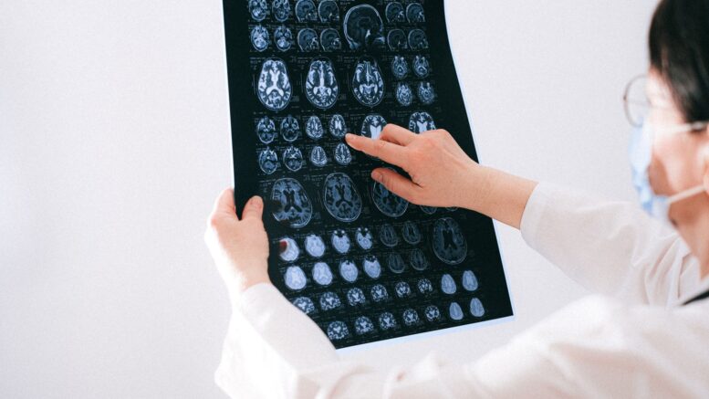 Cerebro humano podría haberse formado