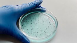 Patrón aparece unas mediciones bacterias