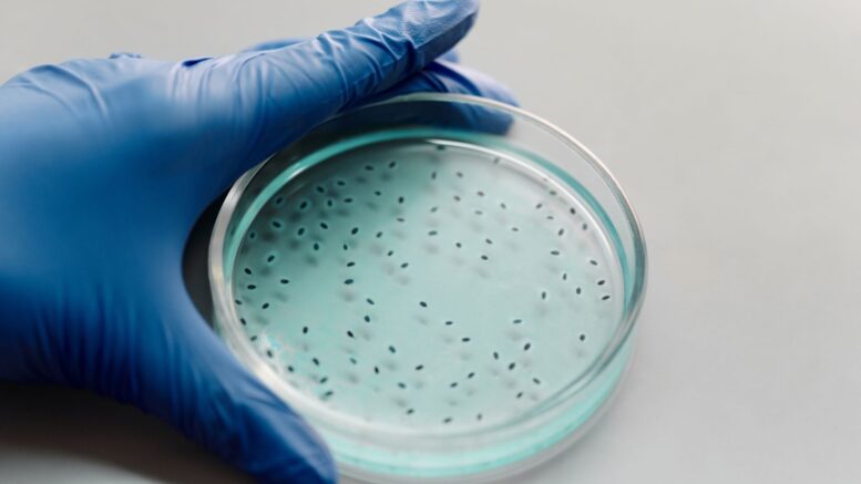 Patrón aparece unas mediciones bacterias